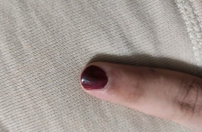 Kız olmak istiyorum ama henüz daha kimseye açılamadım bile. Ne yapmalıyım?