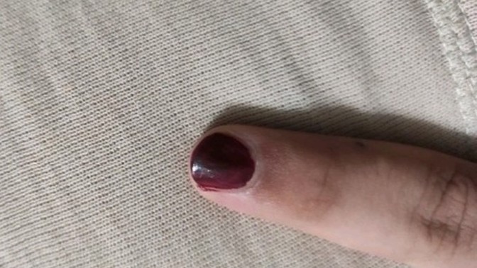 Kız olmak istiyorum ama henüz daha kimseye açılamadım bile. Ne yapmalıyım?