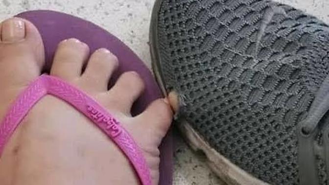 Bu sıcaklar da temas bağımlısı sevgilin olsaydı tepkin ne olur du?