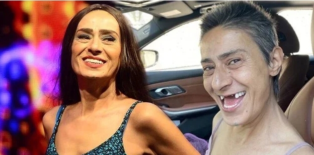 Yıldız Tilbenin dişsiz fotoğrafları sosyal medyada gündem oldu! Hiç implant tedavisi oldunuz mu?