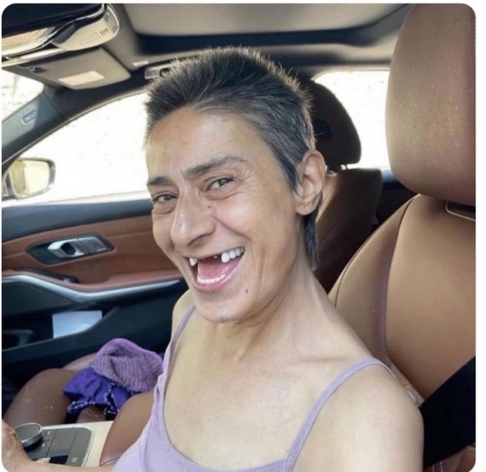 Yıldız tilbe nin en doğal estetiksiz haline özgüveni ne ve kendisine hayranım?
