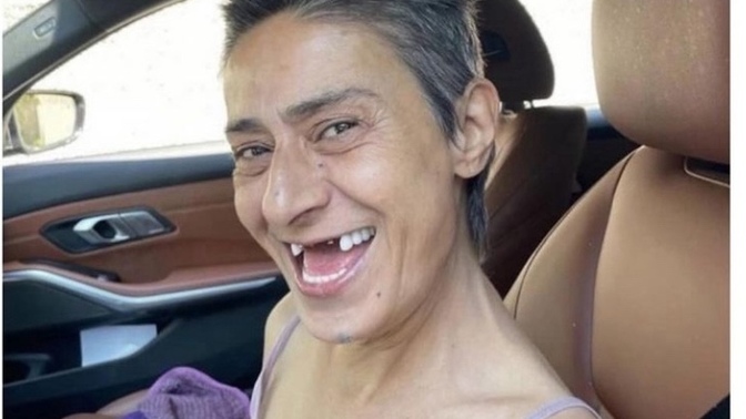 Yıldız tilbe nin en doğal estetiksiz haline özgüveni ne ve kendisine hayranım?