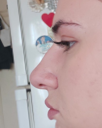 Sizce bu burun güzel mi?