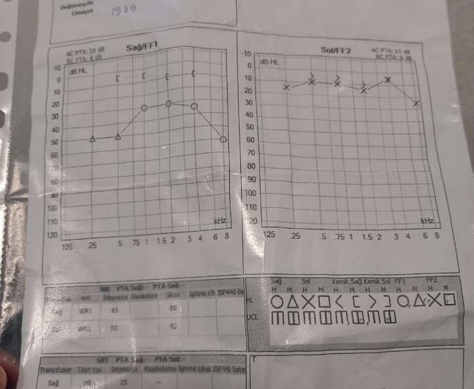 İşitme testinden anlayan var mı aaaa dostlar?