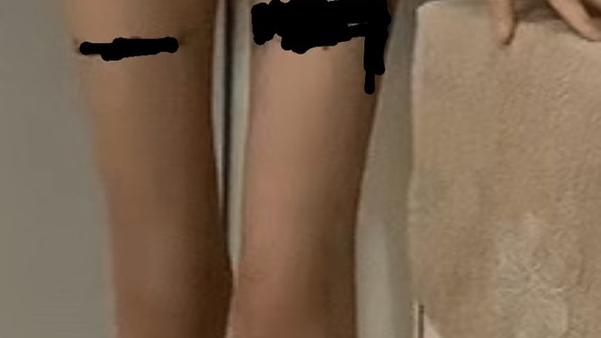 Sizce bacaklarım çok ince mi KÖTÜ DURUYOR MU?