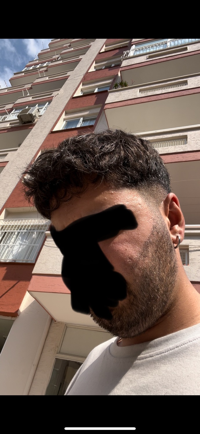 Objektif olarak cildim nasıl?