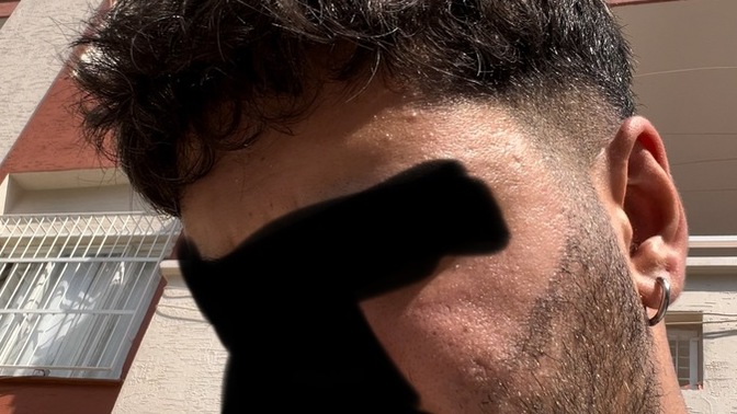 Objektif olarak cildim nasıl?
