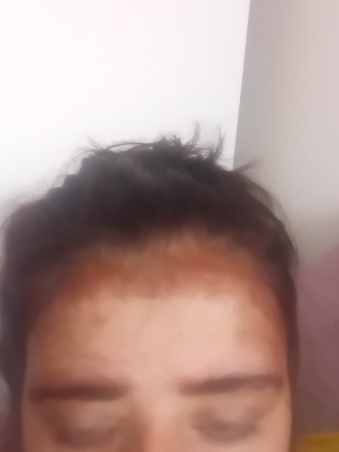 Kurumuş saç boyası lekesi nasılsın geçer?