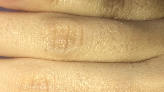 Kızlarda parmak üstünde böyle tüyler olması normal mi ağdayla alıyordm ama çıkıyor sürekli artık bazen cımbızla çekiyorum az olunc?