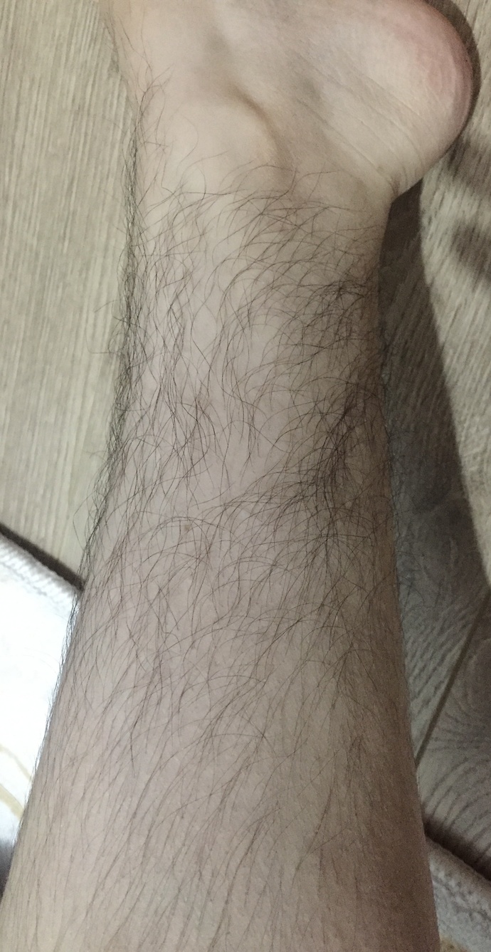 Yargılamazsınız umarım ama ben beyaz tenliyim ve vücudumda üst bacakta pek tüy olmamasına rağmen ayak bileklerim alt bacağım neden?