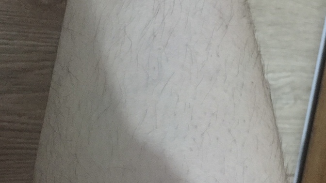 Yargılamazsınız umarım ama ben beyaz tenliyim ve vücudumda üst bacakta pek tüy olmamasına rağmen ayak bileklerim alt bacağım neden?