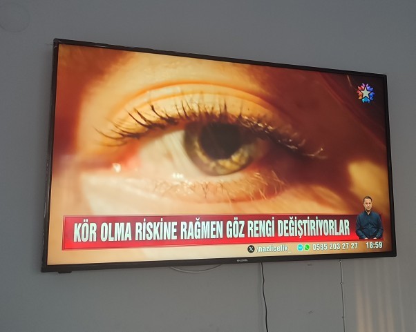 İmkanınız olsa göz renginizi değiştirmek ister miydiniz?