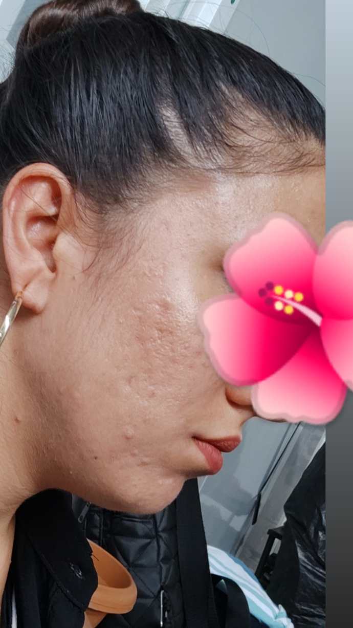 Bu izler kesin olarak nasıl geçer?