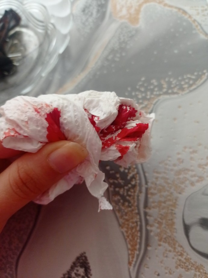 Parmağımı kestim kan durmuyor?
