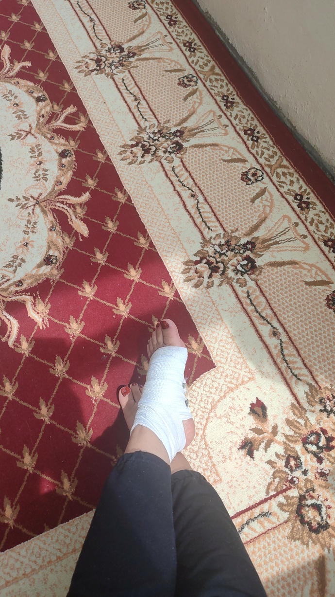 Burkulmuş ayağa ne iyi gelir?