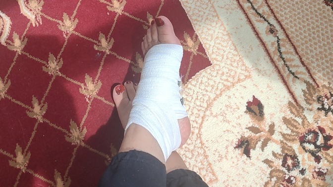 Burkulmuş ayağa ne iyi gelir?