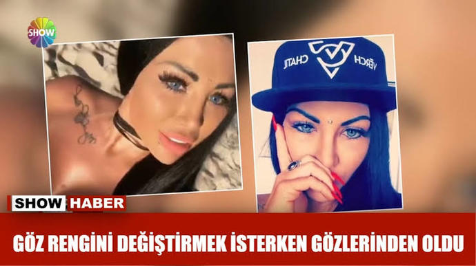 Sırf renkli göze sahip olmak için bıçak altına yatar mıydınız?