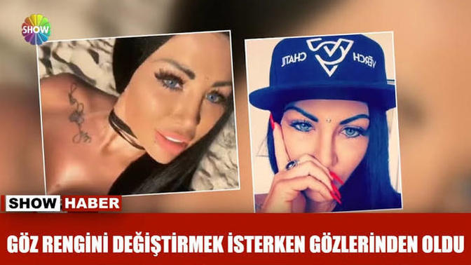 Sırf renkli göze sahip olmak için bıçak altına yatar mıydınız?