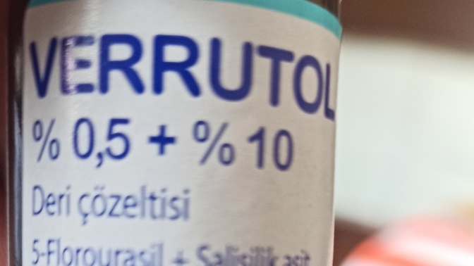 Farklı siğil türleri nelerdir ve nasıl oluşurlar?