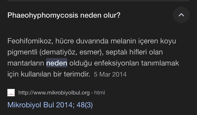 Sabah 6 gibi yattım 11 de uyandım ve iki elimde kına renginde leke var?