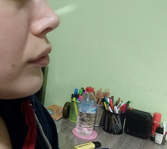 Burun estetiğimin üzerinden iki buçuk yıl geçti sizce ucu top gibi mi?