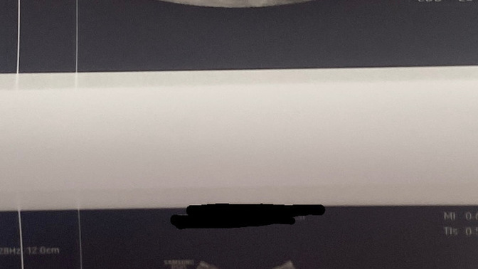 Alalım bakalım tahminlerinizi sizce cinsiyet ne?