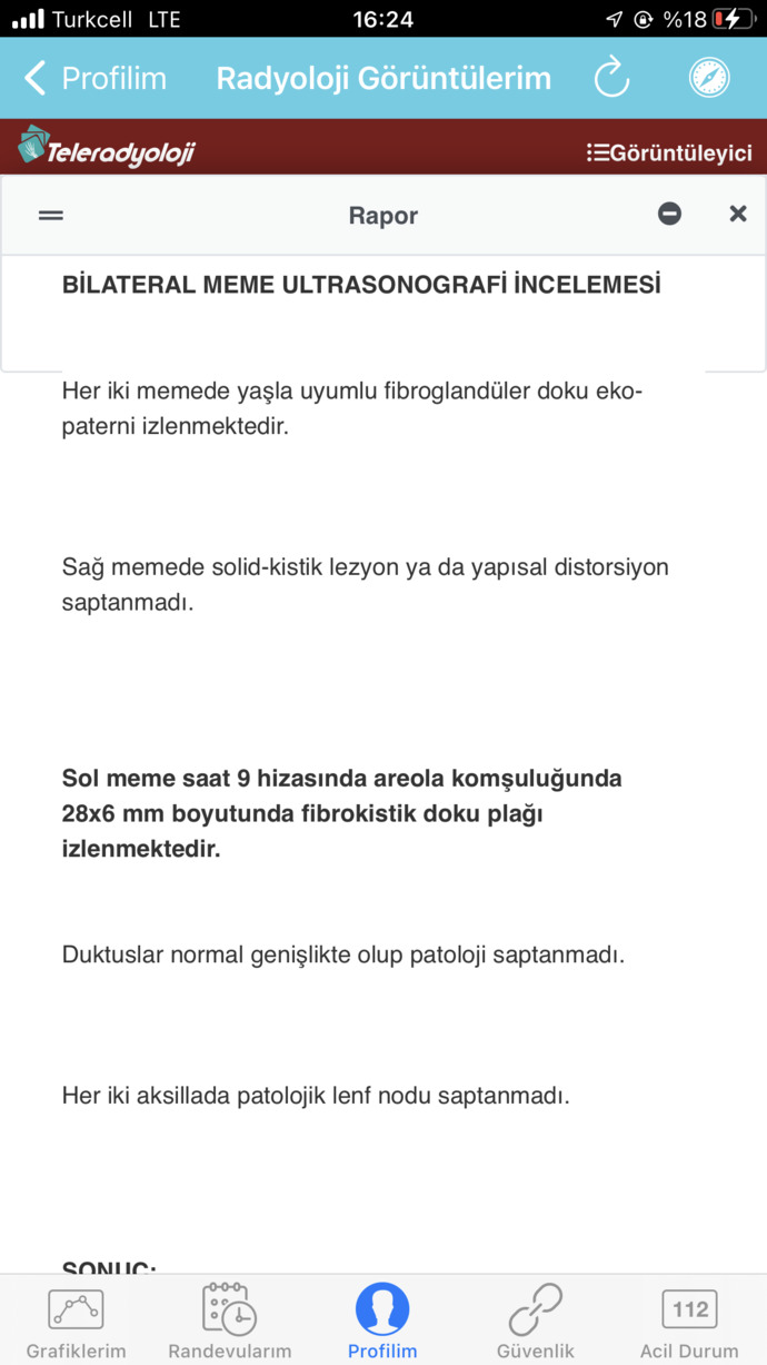 Meme ultrasonum üsteki 2021 diğeri 2022 doktor onemli değil dedi ama neden meme ucum hala ağrıyor?