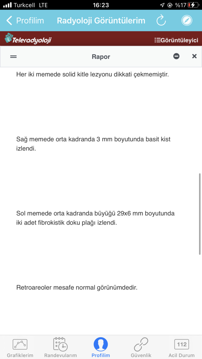Meme ultrasonum üsteki 2021 diğeri 2022 doktor onemli değil dedi ama neden meme ucum hala ağrıyor?