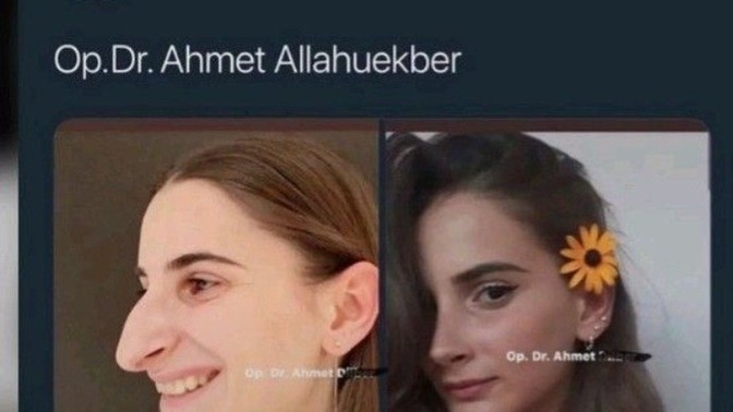 Estetiğiniz var mı ya da estetiğe karşı mısınız?