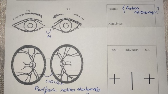 Gözde uçuşan cisimler?
