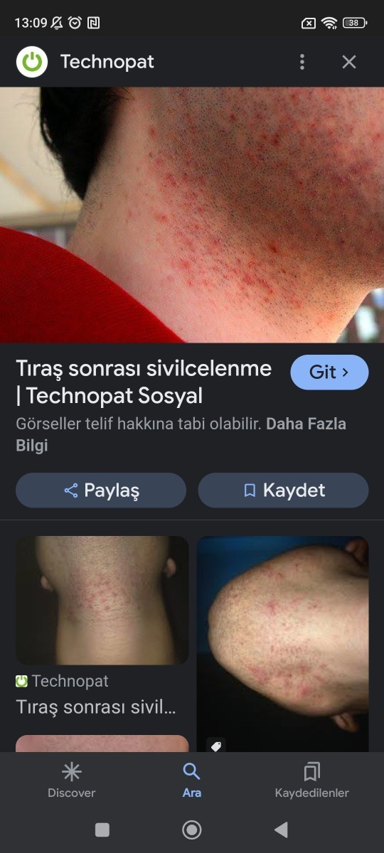 Traş sonrası cildim tahriş oluyor ne yapmalıyım?