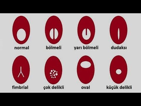 Gerdek gecesi evlendiğiniz kişinin bakir/bakire olmadığını anlasaydınız, nasıl bir tepki verirdiniz?