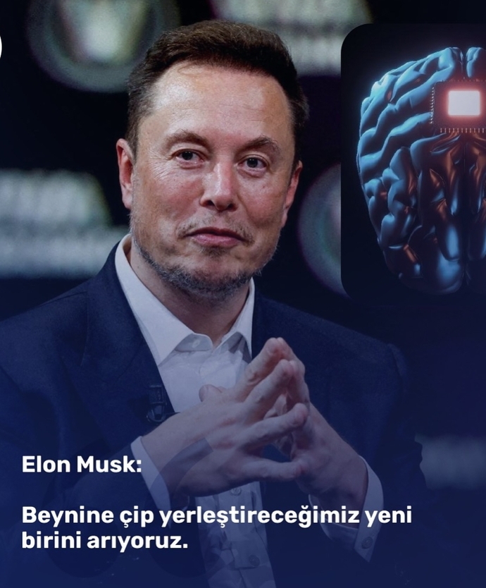 Astronomik bir ücret karşılığı beyninize çip yerleştirmek isteseler kabul eder miydiniz?