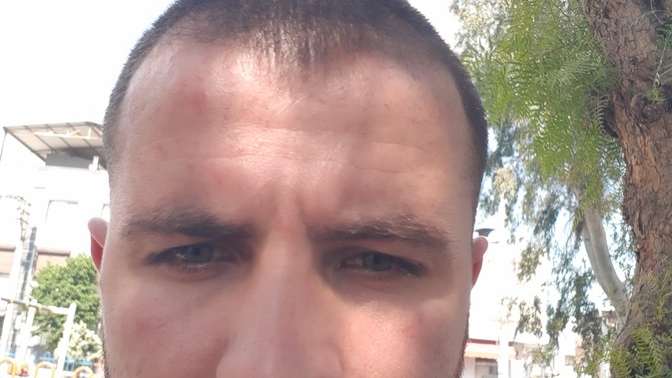 Kafamın yamukluğunu kapatacak bir sac kesimi önerirmisiniz?