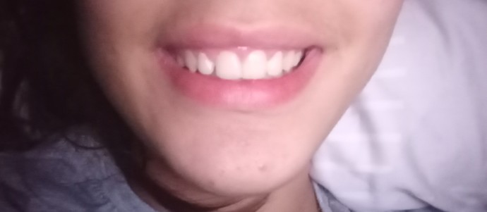 Gülüşümü sevmiyorum, sizce haklı mıyım?