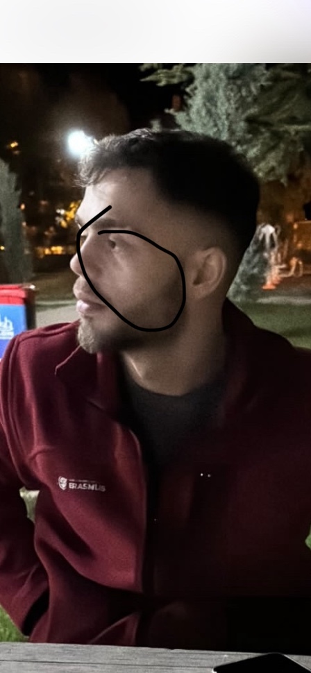 Suratım bulldog yüz oldu ne yapmalıyım?