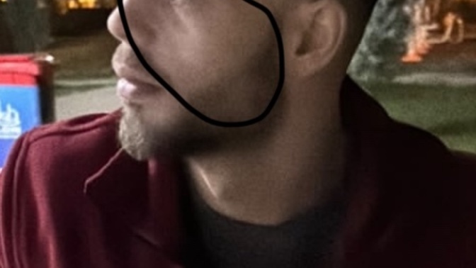 Suratım bulldog yüz oldu ne yapmalıyım?