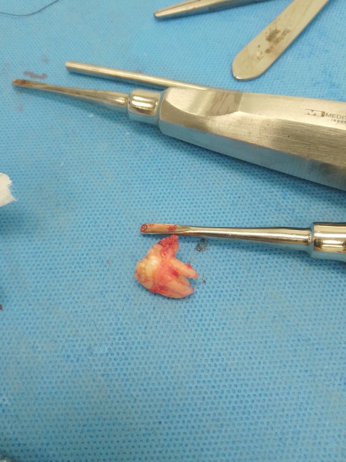 Aranızda diş doktoru varsa acil soruyu cevaplasın?