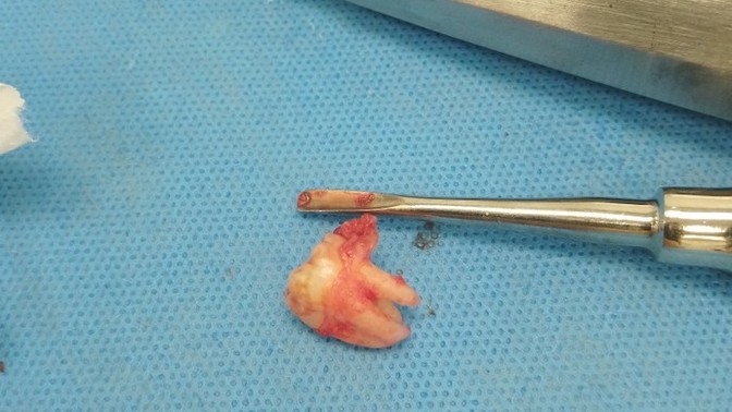Aranızda diş doktoru varsa acil soruyu cevaplasın?