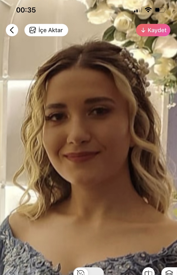 Burun estetiği yaptırmak istiyorum ama kararsızım?