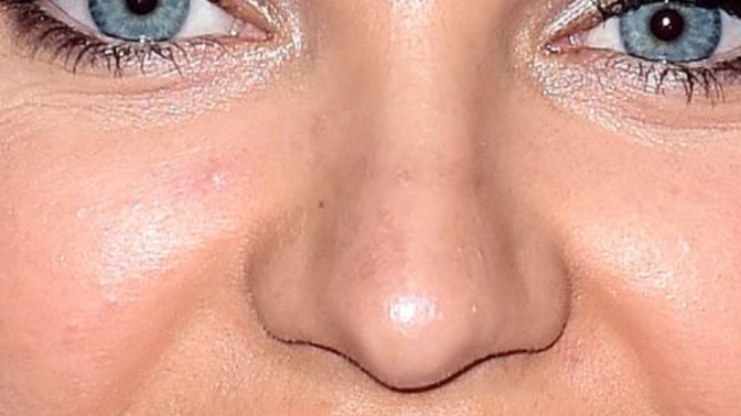Candice swanepoelin bile bıyıkları var?