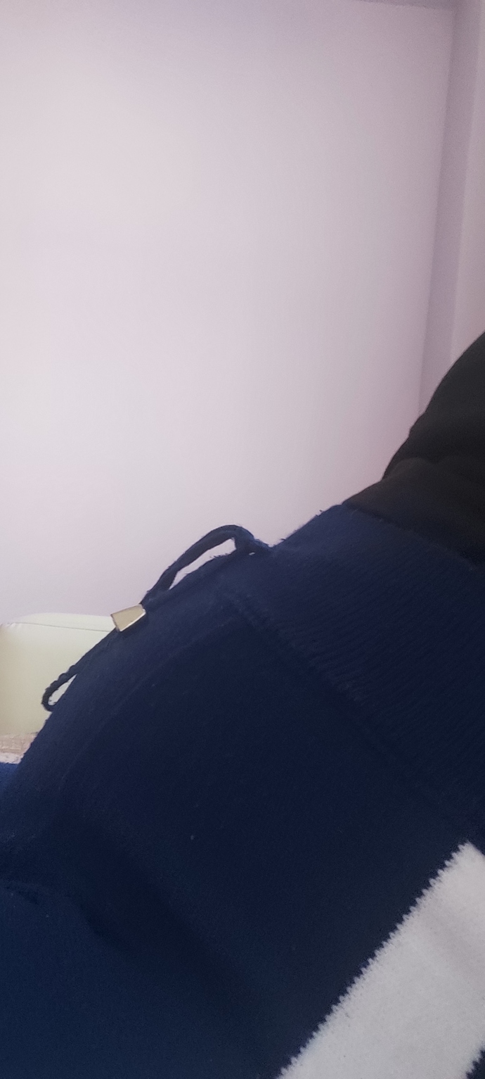 Bu göbek niye böyle hastalık mı var acaba?