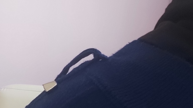 Bu göbek niye böyle hastalık mı var acaba?