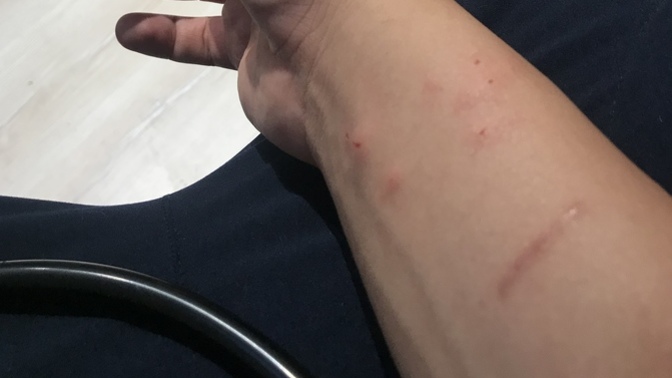 Hıncını alamadı üç kere ısırdı, sahip çıkın şu hayvansı çocuklarınıza?