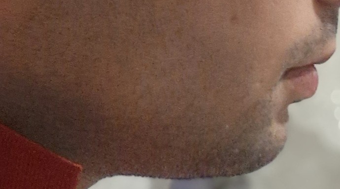Çenem çok mu geride?