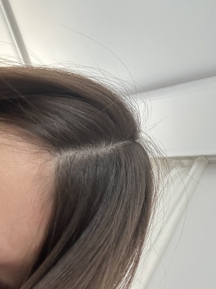Keratin yaptim saçim kafama çok mu yapişmiş sizce?