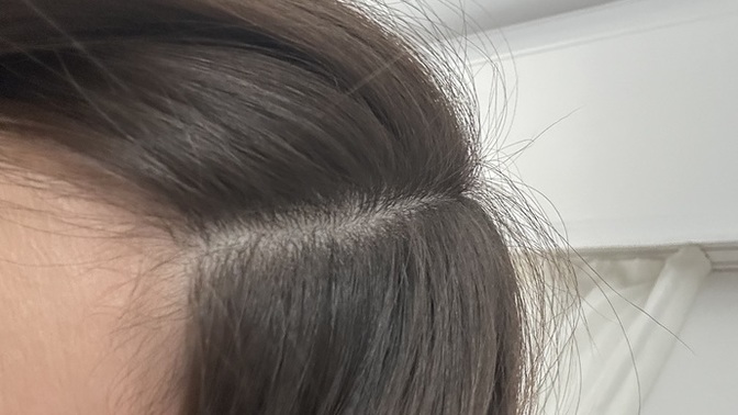 Keratin yaptim saçim kafama çok mu yapişmiş sizce?