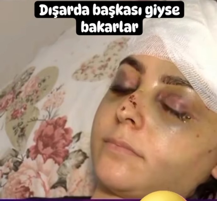 Evli kadın taytla gezebilir mi?