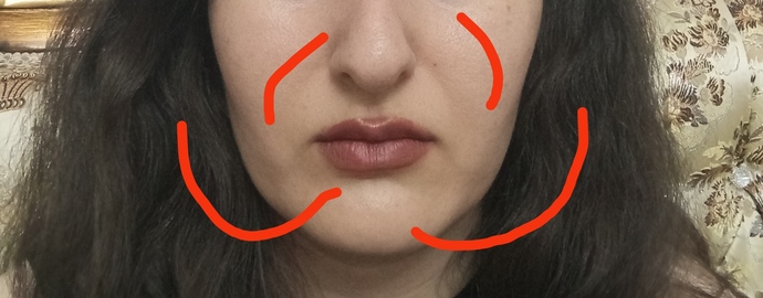 Yuzumun su kisimlarini hic begenmiyorum nasil bi islem yapilabilir? Cukur gormek istemiyorum?