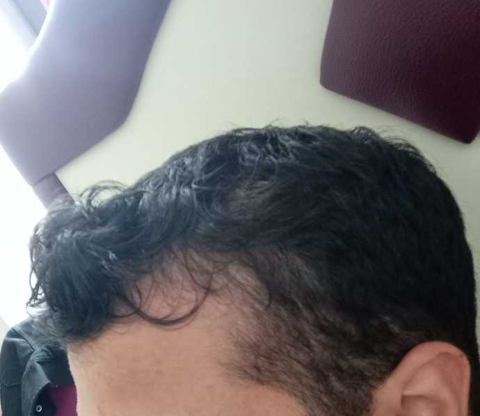 Saçlarım ne zamana kadar dayanır sizce?